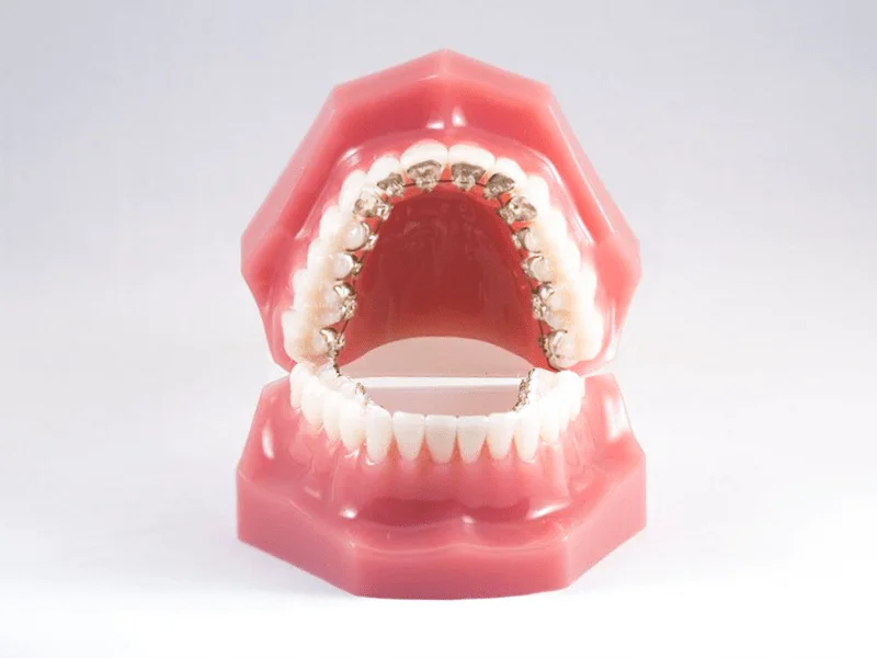 hình ảnh Mắc cài kim loại mặt trong